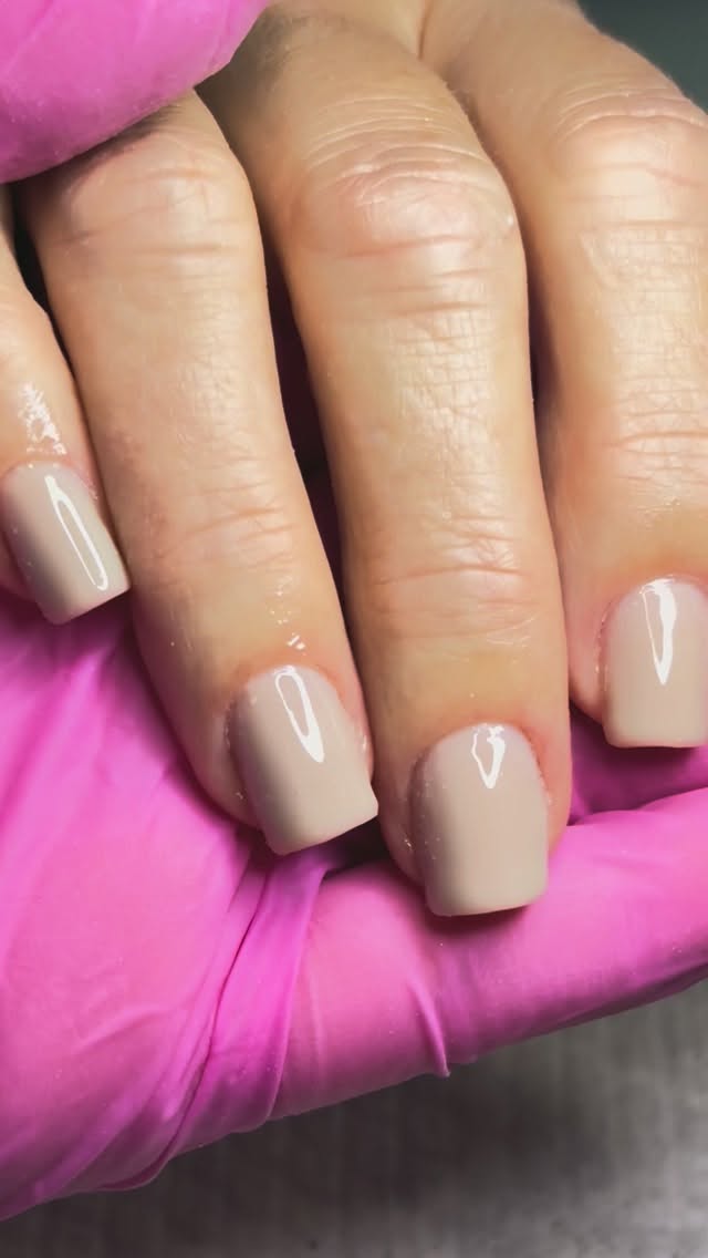 Retirada de gel